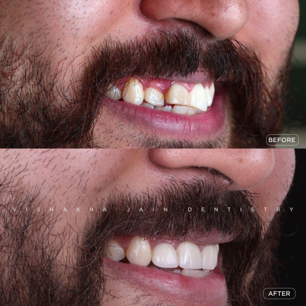 dental-clinic-indore